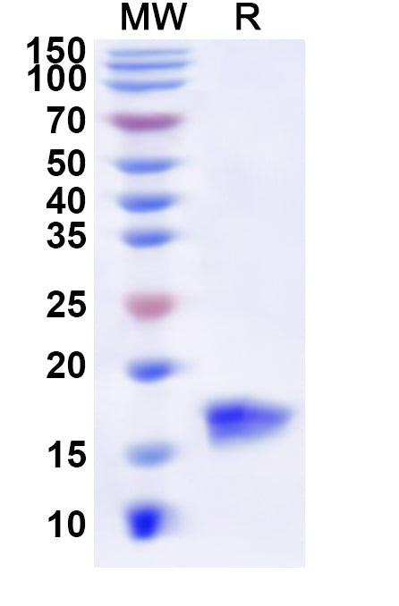 SDS-PAGE for Recombinant Human MTPN Protein, N-His