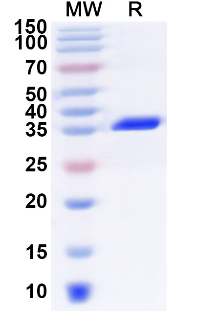 SDS-PAGE for Recombinant Human NDUFC2 Protein, N-GST & C-His