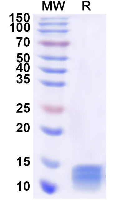 SDS-PAGE for Recombinant Human PCBD1 Protein, N-His