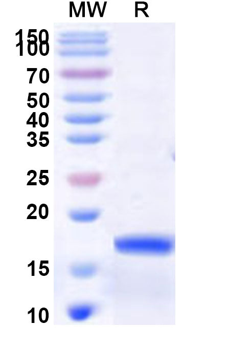 SDS-PAGE for Recombinant Human PHLPP2 Protein, N-His