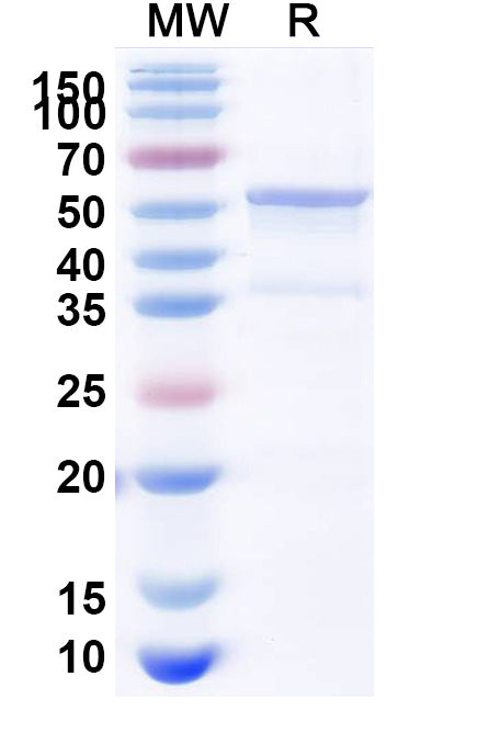 SDS-PAGE for Recombinant Human PPP2R2A Protein, N-His