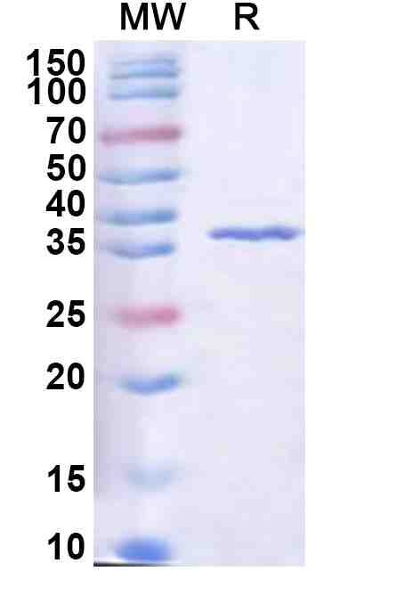Recombinant Human RASSF2 Protein, N-His