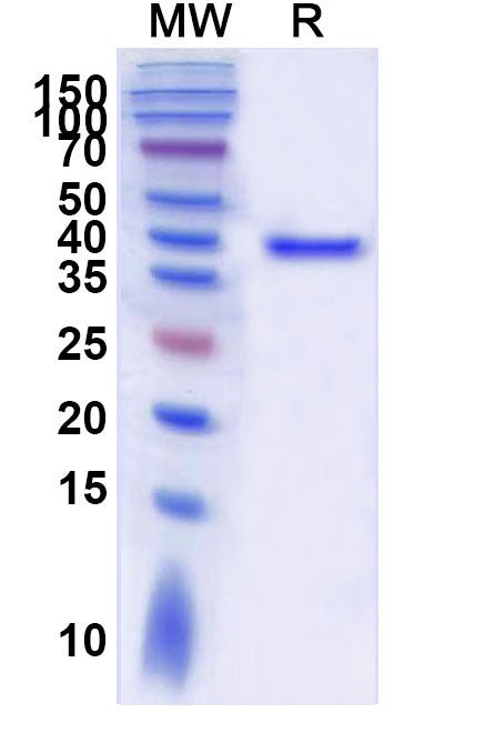 SDS-PAGE for Recombinant Human RFWD3 Protein, N-His