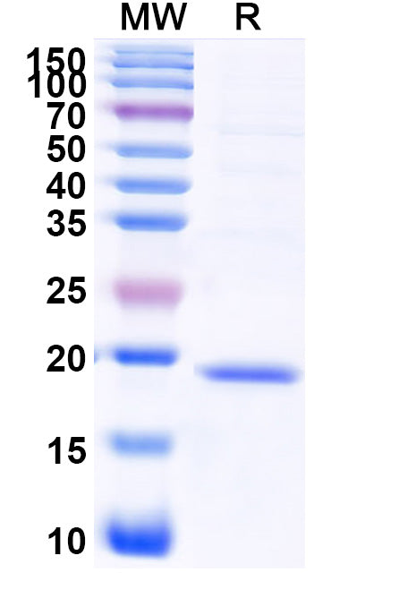SDS-PAGE for Recombinant Human RPL17 Protein, N-His