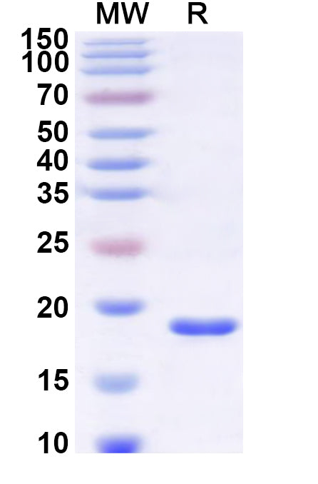 SDS-PAGE for Recombinant Human SEC24A Protein, N-His