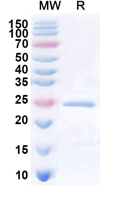 SDS-PAGE for Recombinant Human SLC5A3 Protein, N-His-KSI