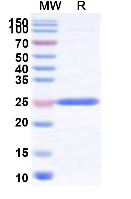 SDS-PAGE for Recombinant Human SRSF5 Protein, N-His