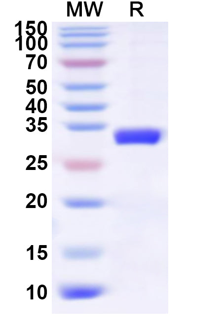 SDS-PAGE for Recombinant Human TRIM40 Protein, N-His