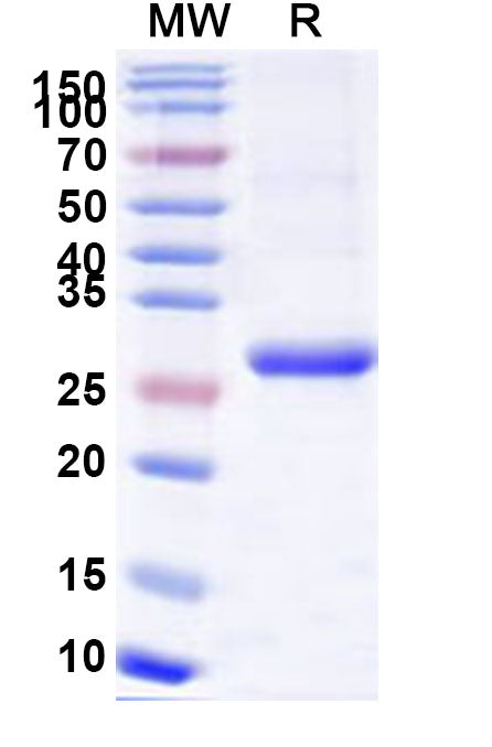 SDS-PAGE for Recombinant Human TSHR, N-His