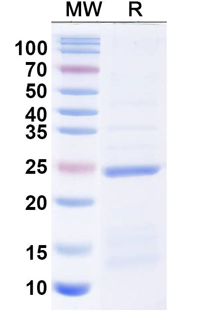 SDS-PAGE for Recombinant Human UPK3A, N-His