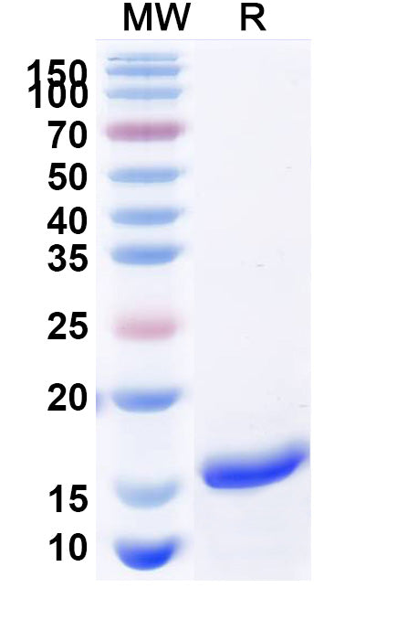 SDS-PAGE for Recombinant Human UTP14A Protein, N-His