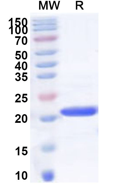 SDS-PAGE for Recombinant Human VBP1 Protein, N-His