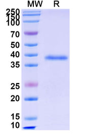 SDS-PAGE for Recombinant Human VCAN, N-His