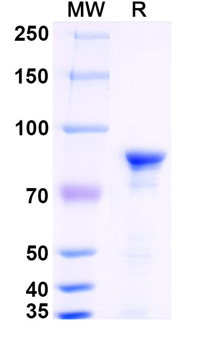 SDS-PAGE for Recombinant Mouse HSPA5/BIP Protein, N-His