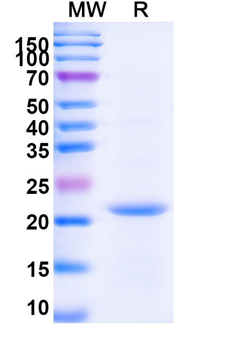 SDS-PAGE for TBP, N-His, recombinant protein