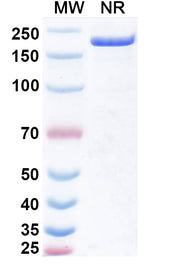 SDS-PAGE for Research Grade Obertamig