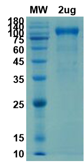 SDS-PAGE for ACE2 protein - Soluble ectodomain of human ACE-2 (aa 1-740)