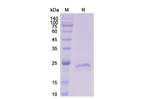SDS-PAGE for CD20 Protein - Human CD20 Recombinant Protein