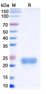 SDS-PAGE For Monkeypox virus/MPXV C15L Recombinant Protein, C-His