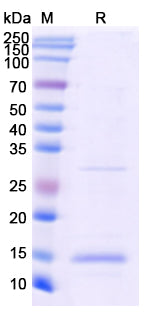 SDS-PAGE For Recombinant Monkeypox virus/MPXV A33R Protein, N-His