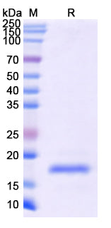 SDS-PAGE For Recombinant Monkeypox virus/MPXV A36R Protein, N-His