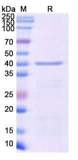 SDS-PAGE For Recombinant Monkeypox virus/MPXV C19L Protein, N-His
