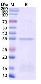 Recombinant Monkeypox virus/MPXV D13L Protein, N-His