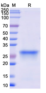 SDS-PAGE For Recombinant Monkeypox virus/MPXV D14L Protein