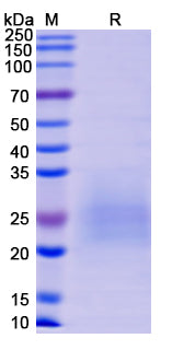 SDS-PAGE For Recombinant Monkeypox virus/MPXV M1R Protein