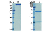 SDS-PAGE for Spesolimab Biosimilar - Anti-IL36RN mAb - Research Grade