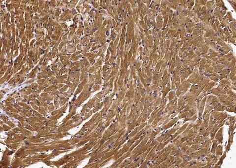 Anti-Mouse IL6ST Antibody [B413] - ABMIUM