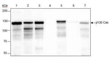 Anti-Human/Rat/Mouse p130 Cas Antibody [A317]