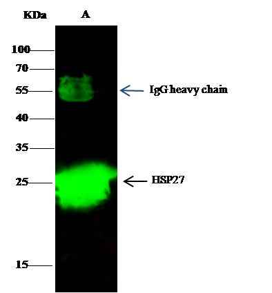 Anti-Human HSPB1 Antibody [B246] - ABMIUM