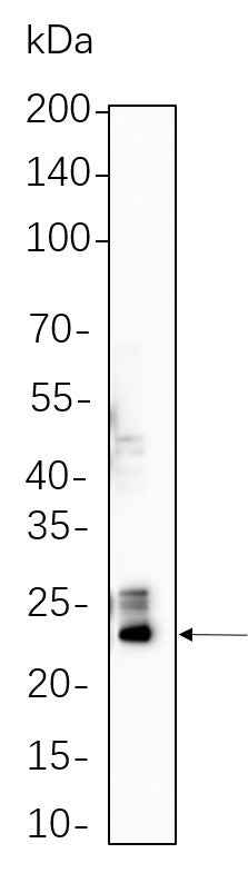 Anti-Human/Mouse/Rat GPX4 Antibody [B665] - ABMIUM