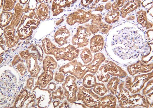 Anti-Human/Mouse/Rat PGK1 Antibody [B1049] - ABMIUM