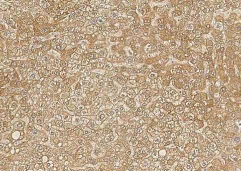 Anti-Human BTD Antibody [B206] - ABMIUM