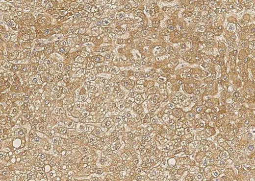 Anti-Human BTD Antibody [B206] - ABMIUM
