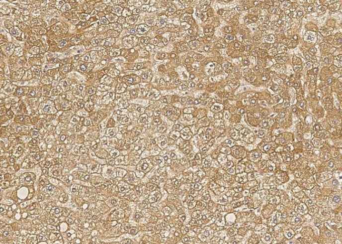 Anti-Human BTD Antibody [B206]