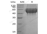 Recombinant Human TXNDC15 Protein (His Tag) - ABMIUM