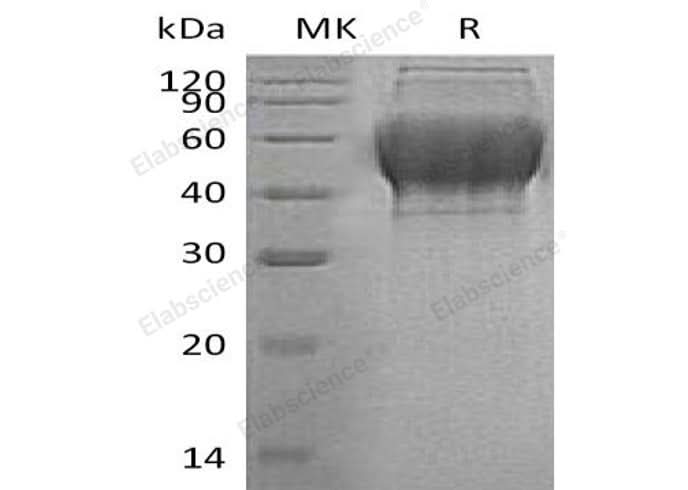 Recombinant Human TXNDC15 Protein (His Tag) - ABMIUM