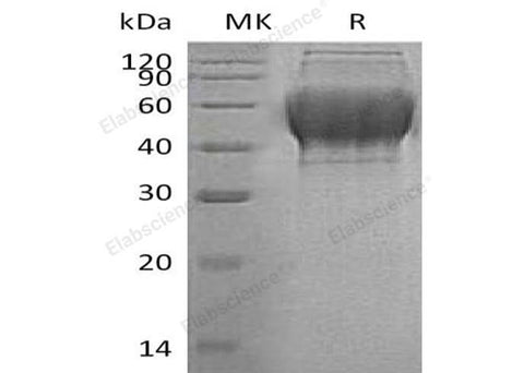 Recombinant Human TXNDC15 Protein (His Tag) - ABMIUM