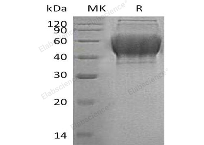 Recombinant Human TXNDC15 Protein (His Tag) - ABMIUM