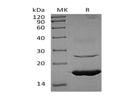 Recombinant Human Ube2L6 Protein (His Tag) - ABMIUM