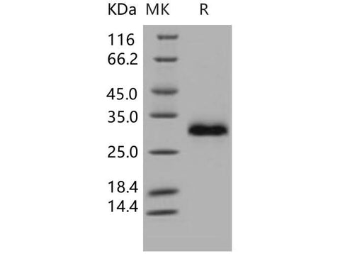 Recombinant Human TIMP-1/TIMP1 Protein (His Tag) - ABMIUM