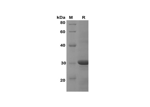 SDS-PAGE analysis of Human CCL23/MPIF-1 proteins, 2 μg/lane of Recombinant Human CCL23/MPIF-1 proteins was resolved with SDS-PAGE under reducing conditions, showing bands at 30 kDa.
