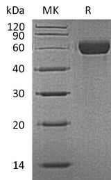 Recombinant Mouse MARCO Protein (His Tag) - ABMIUM