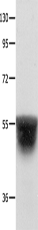 Anti-Human/Mouse/Rat KCNA1 Antibody - ABMIUM