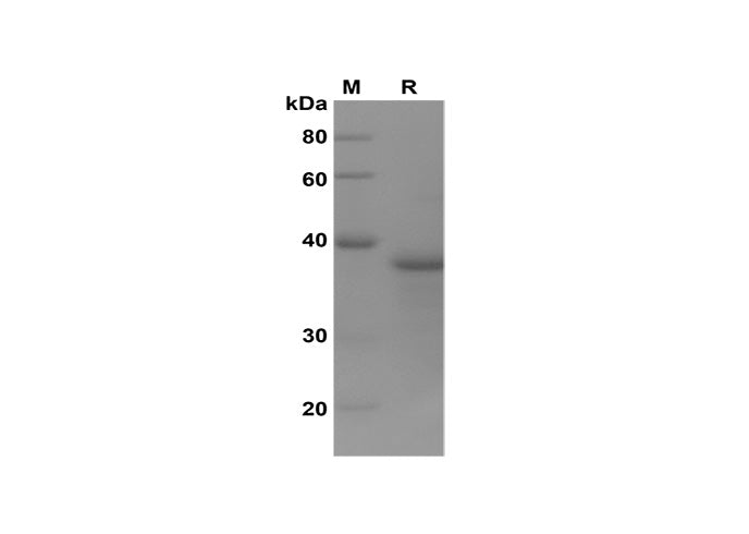 SDS-PAGE analysis of Human MLKL proteins, 2 μg/lane of Recombinant Human MLKL proteins was resolved with SDS-PAGE under reducing conditions, showing bands at 38 kDa.