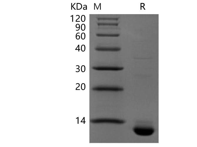 Recombinant Human CLDN18.2(His & Avi Tag) - ABMIUM