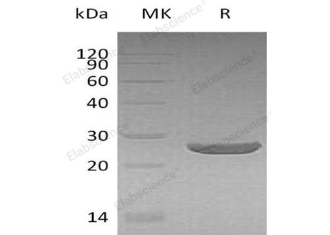 Recombinant Human Peroxiredoxin 1/PRDX1 Protein (His Tag) - ABMIUM
